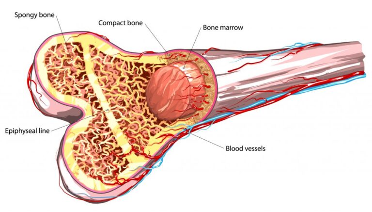 Bone Marrow Transplant Cost in India