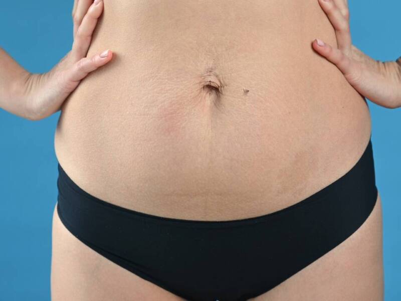 women's stomach