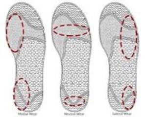 running-shoe-wear-patterns