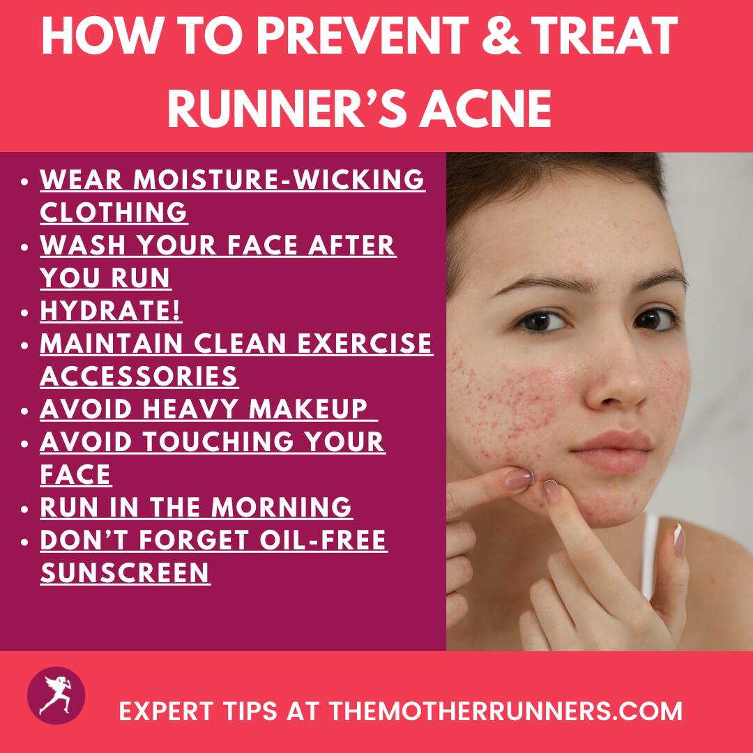 EXPERT TIPS TO AVOID RUNNERS ACNE post