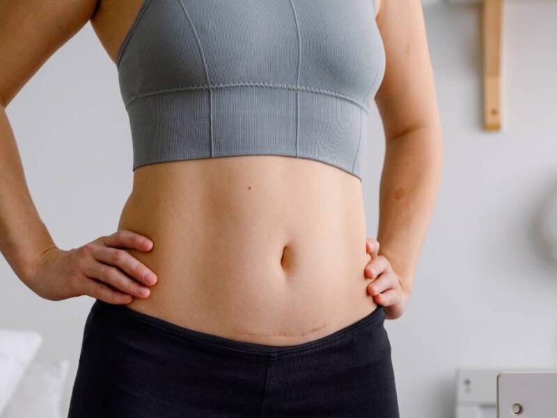 women in sports bra with c section scar