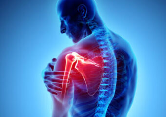 Shoulder replacement